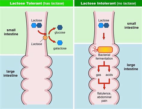 Does Lactase Help With Lactose Intolerance