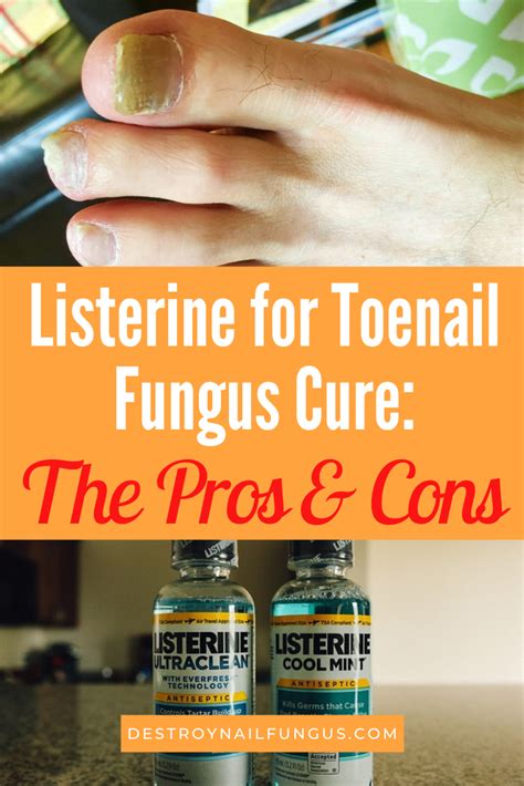 Does Listerine Kill Fungus