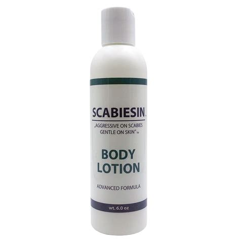 Does Lotion Kill Scabies