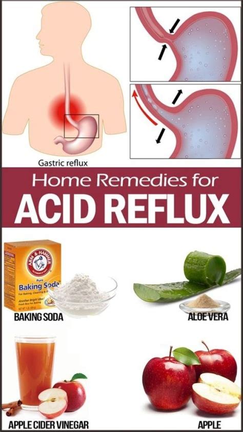does mebeverine help acid reflux