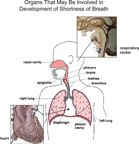 does meningitis cause shortness of breath