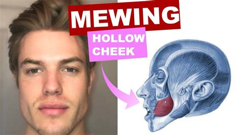 does mewing give you hollow cheeks