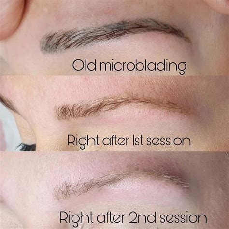 Does Microblading Not Work Sometimes