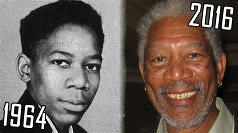 does morgan freeman have vitiligo