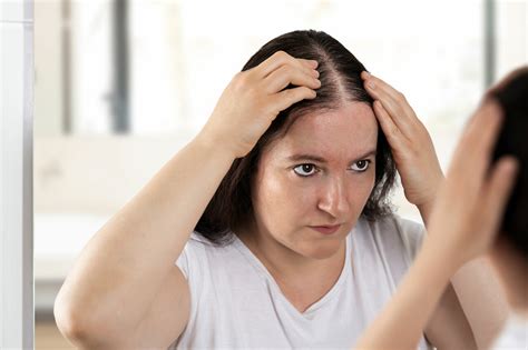 does ms treatment cause hair loss