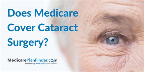 does my medicare cover cataract surgery