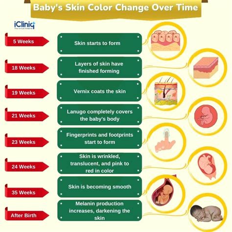 Does Newborn Complexion Change