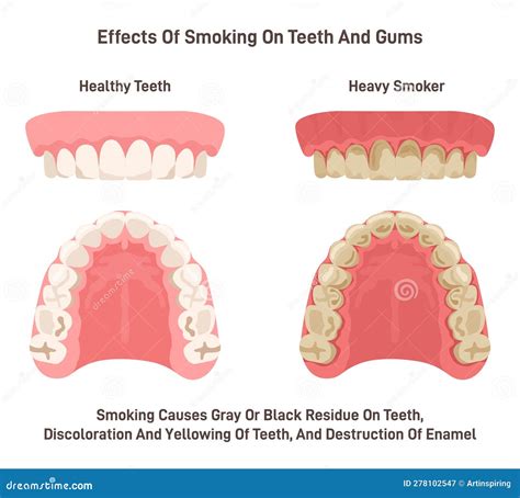 Does Nicotine Gum Damage Your Teeth