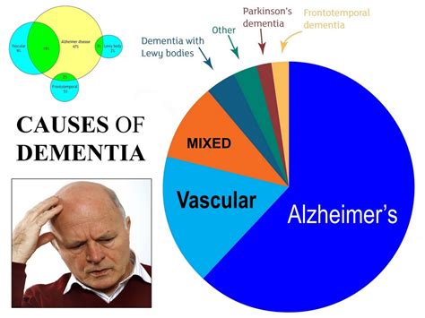 does parkinson's always cause dementia