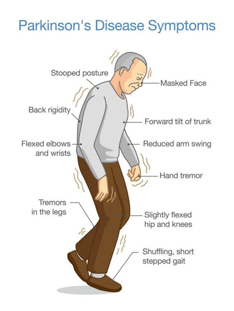 does parkinson's cause delusions