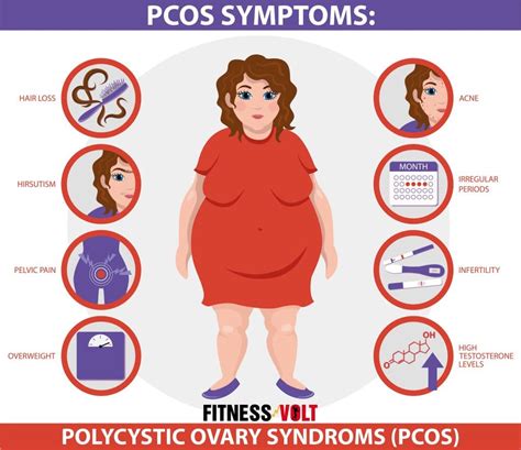 Does Pcos Always Cause Weight Gain