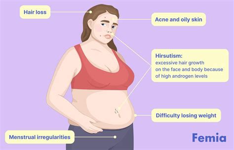 Does Pcos Make You Obese