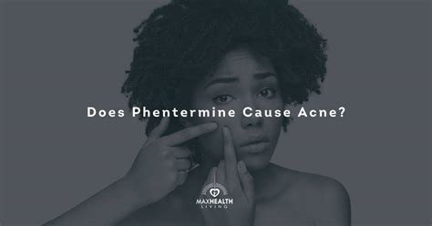 does phentermine cause acne