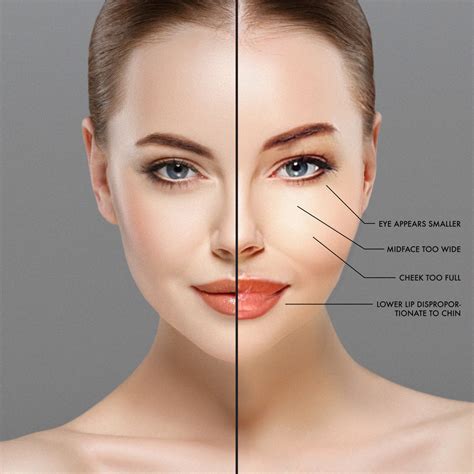 Does Pillow Face Go Away