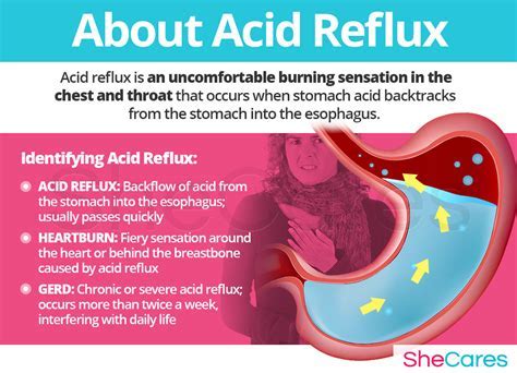 Does Prednisone Help Acid Reflux