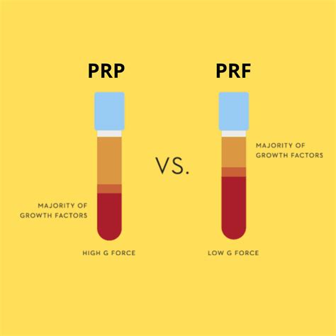 Does Prp Make A Difference