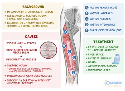 Does Quadriceps Tendonitis Go Away