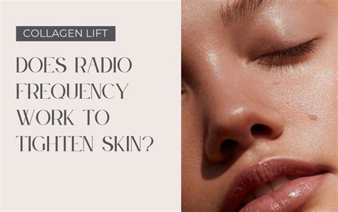 Radiofrequency Injections Vista Clinic Melbourne