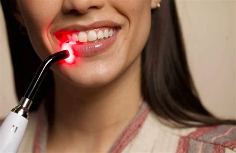 Does Red Wine Trigger Cold Sores