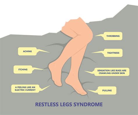 does restless leg syndrome affect sleep