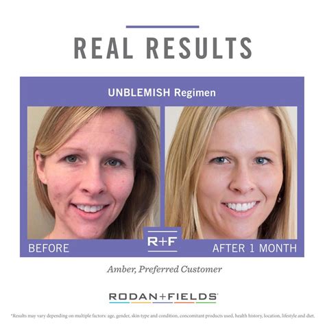does rodan and fields unblemish really work