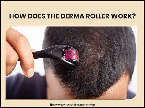 Does Scalp Roller Work