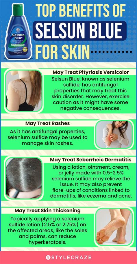 Does Selsun Blue Get Rid Of Ringworm