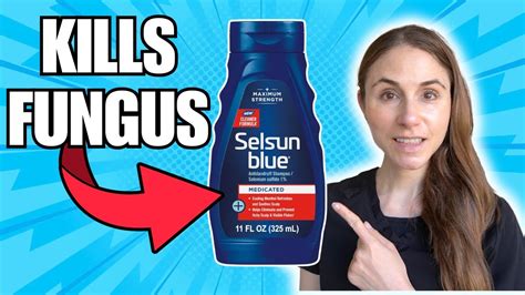 Does Selsun Blue Help Ringworm