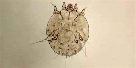 Does Showering Kill Scabies