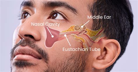 Does Sinus Problems Cause Earache
