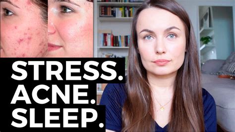 Does Sleep Help With Acne