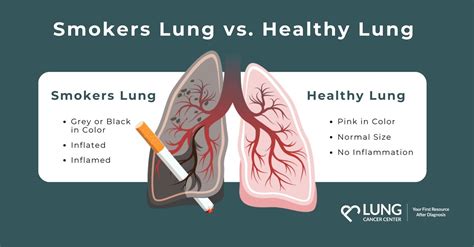 Does Smoking Affect Your Lung Capacity