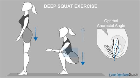 does squatting exercise help with constipation