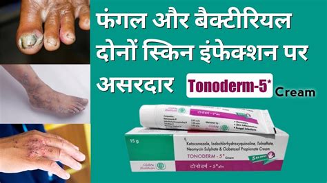 Does Steroid Cream Kill Fungus