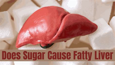 Does Sugar Damage Your Liver