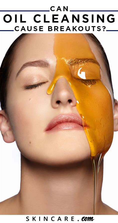 Does Switching Cleansers Cause Breakouts