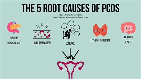 Does Thyroid Cause Pcos