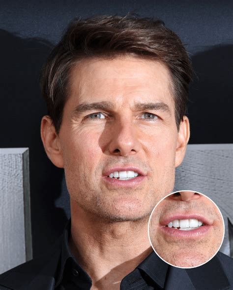 does tom cruise have one front tooth