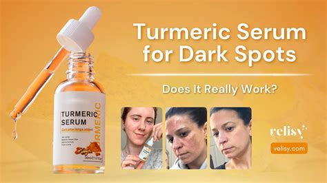 Does Turmeric Really Work For Dark Spots