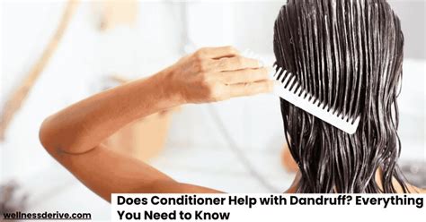 Does Using Conditioner Help Dandruff