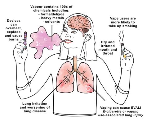 Does Vape Cause Back Pain