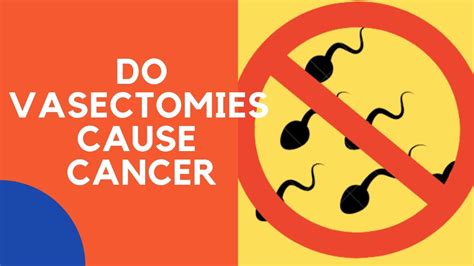 does vasectomy cause cancer