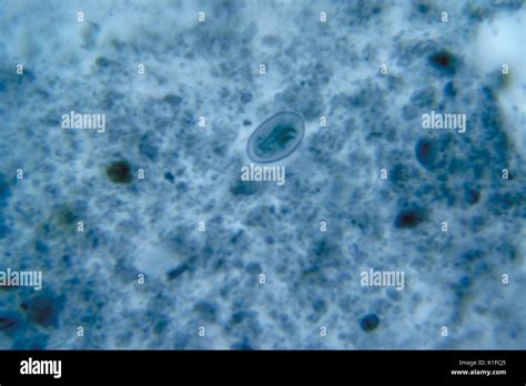 does vinegar kill giardia