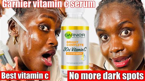 Does Vitamin C Get Rid Of Hyperpigmentation