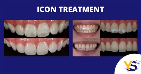 does white spot treatment work