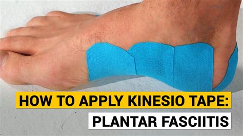 Does Wrapping Help Plantar Fasciitis