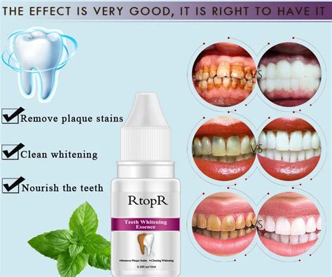 Does Xylitol Whiten Teeth