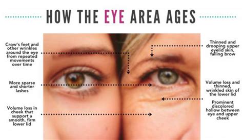 does your eye shape change as you get older