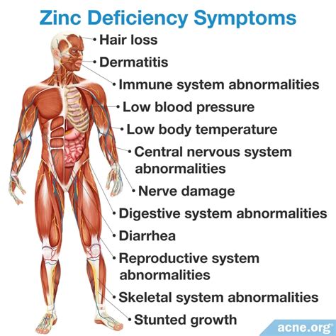 Does Zinc Deficiency Cause Acne