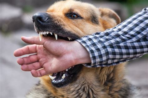 dog bite attorney houston reviews